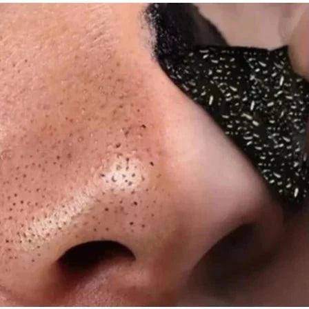 Blackhead Remover Patch with Activated Charcoal - 10-Unit Kit